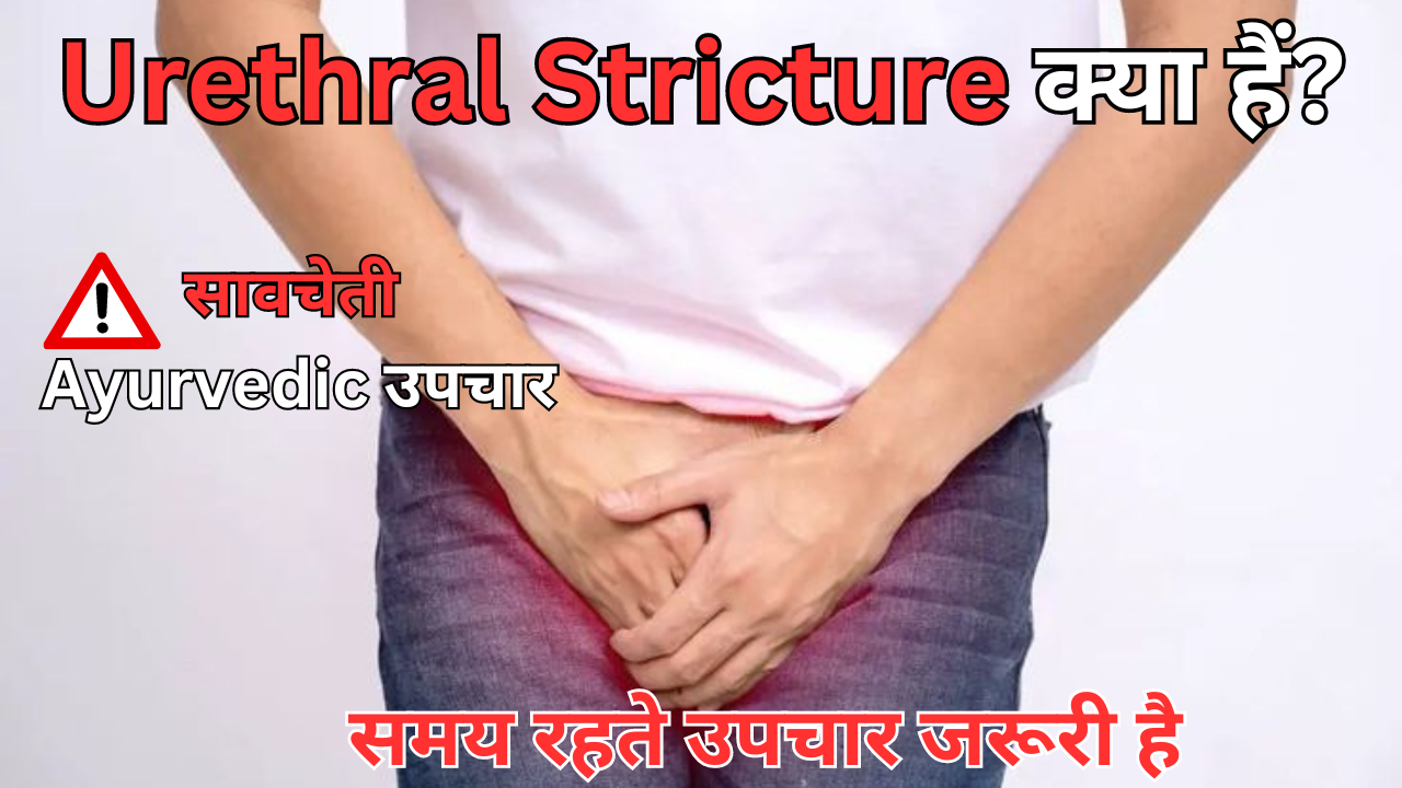 ayurvedic medicine for Urethral Stricture