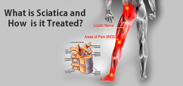 Ayurvedic Treatment for Sciatica