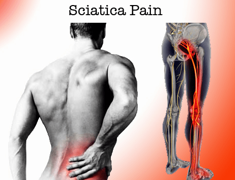 sciatica-pain